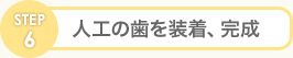 Step6 人工の歯を装着、完成